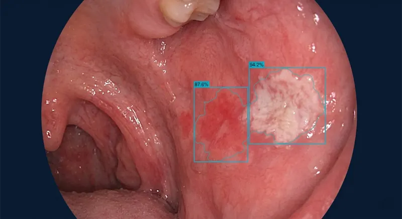 Procen-Mucosa — Oral Mucosa Analysis